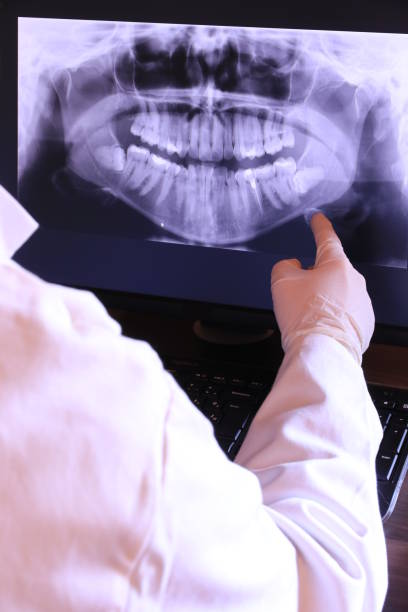 Best Root Canal Emergency Dentist  in Okawvle, IL